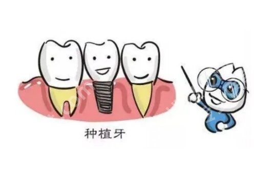 北京盖德口腔门诊部种植牙价格是多少?费用明细及医生介绍一览