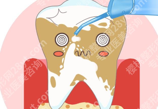 合肥滨湖医院牙科洗牙多少钱？院内口碑医生推荐！洗牙案例