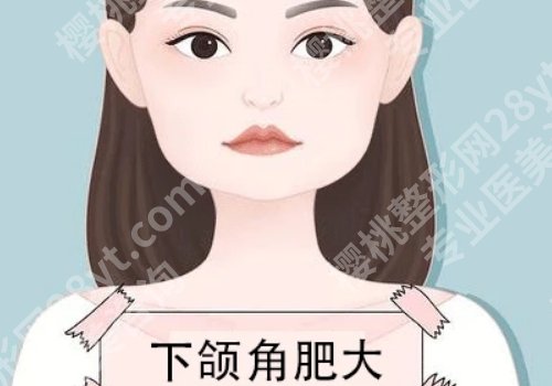 北京圣嘉荣做鼻子多少钱？医院、医生详情信息一览