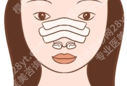 天津一中心医院做隆鼻得技术好不好？真人鼻部整形全过程记录！