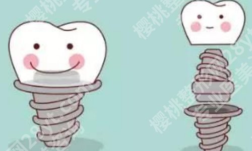 北京地坛口腔种植牙多少钱?科室信息与网友真实评价