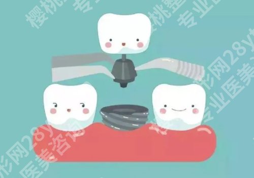 北大口腔医院种牙挂什么科？医院都有哪些优势？