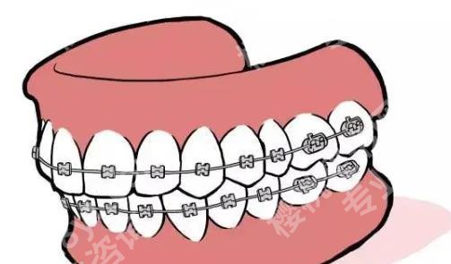 北京中诺口腔医院牙齿科怎么样？医院真实的口碑点评及案例鉴赏来袭