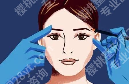 广东省人民医院割双眼皮技术成熟吗？来看看院内经典案例图