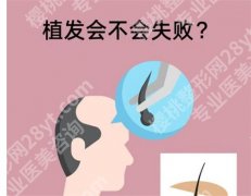 天津三甲医院可以植发吗？专业技术一览，好评如潮
