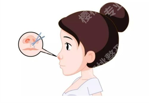 荔湾人民医院整形科怎么样？基本信息一览，整形问答