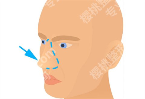 昆明延安医院有整形科吗?热门项目小技巧