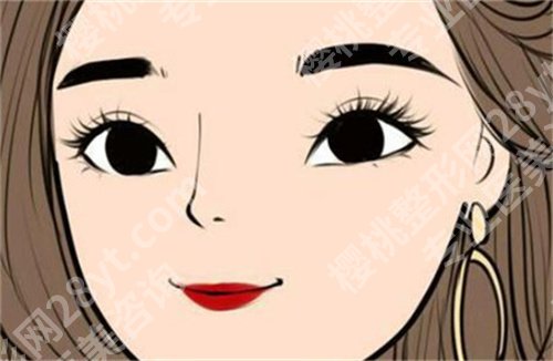 北京爱悦丽格医疗美容开眼角怎么样?附开眼角案例术后恢复图