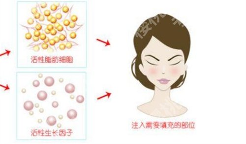 成都华西医院可以丰胸吗？特色项目推荐，技术优势公布