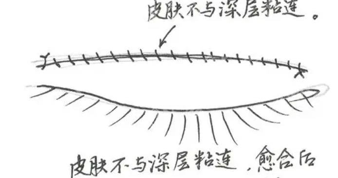 南方医科大学南方医院整形科的技术好不好？真实的口碑点评来袭！