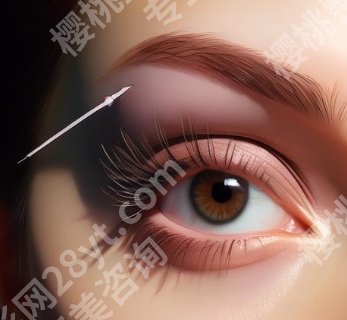 武汉三医院整形外科割双眼皮的技术好不好？核心项目推荐！