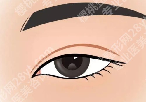 杜园园双眼皮修复技术怎么样？内附医生信息、案例详情！