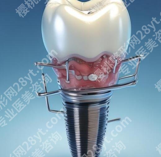 北京中诺口腔医院牙齿做的好吗？医院详细地址及项目参考！