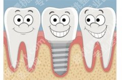 长沙牙齿种植牙手术多少钱？种植牙科普知识讲解，点击预览