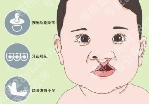 上海范锴做唇裂鼻畸形修复怎么样？医生基本信息及近期案例反馈公布