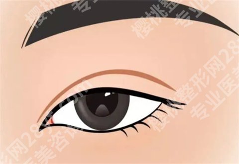 武汉同济医院双眼皮修复做的怎么样？真人案例来了，看反馈