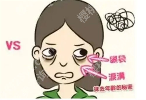 郑州美莱做眼袋手术好的医生是谁？张芳医生在院坐诊，看口碑