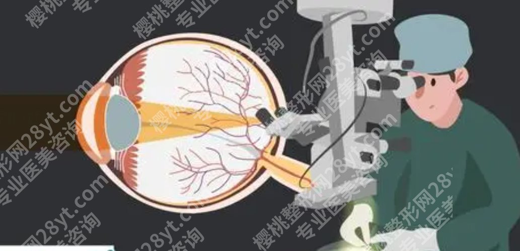 北京华德眼科医院怎么样？院内口碑医生推荐！近视眼案例