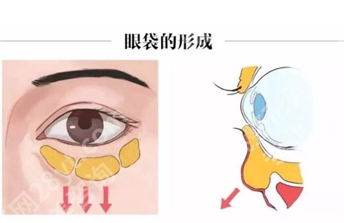 南昌韩美做眼袋怎么样？核心项目大公开，值得一看