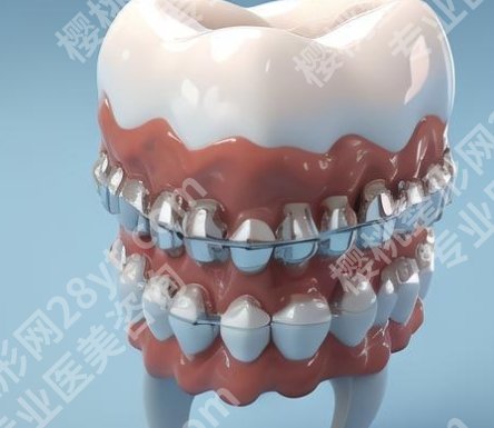 福州东南口腔医院正畸价格贵吗？医院基本信息|一站式掌握