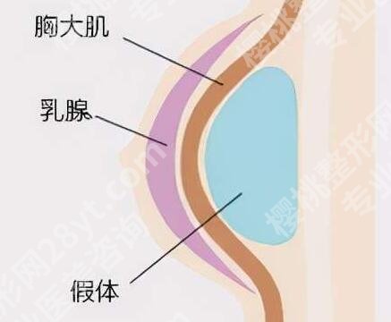 赵亚均隆胸怎么样？含医生信息和口碑点评更新