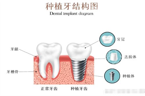 中科领军口腔医院靠谱吗？特色项目助阵你认识