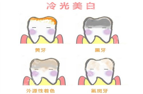 北京枫景口腔医院种植牙咋样？点评技术与案例