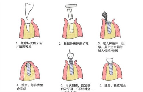 北京美冠塔口腔医院简介，热门项目介绍