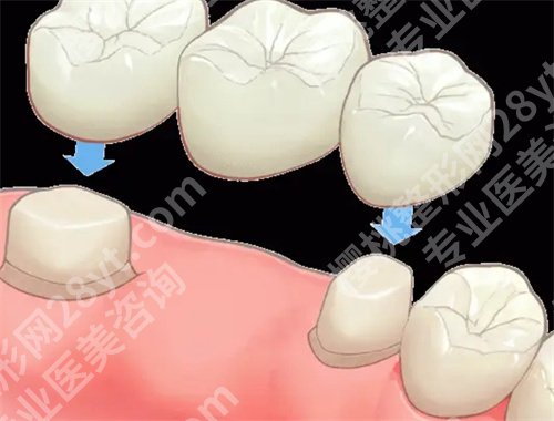 北京劲松口腔医院做牙冠怎么样？项目推荐，医院实力介绍