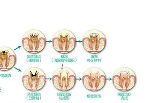 北京德贝口腔医院怎么样？好评在线查