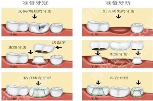 北京斯迈尔口腔种植牙价格表公布，特色项目带你了解