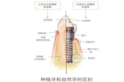 北京斯迈尔齿科正规吗？附全新的价格参考 