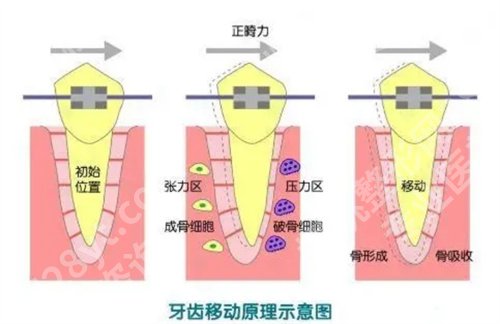 北京佳美口腔医院牙齿矫正价格是多少？看医院详细介绍