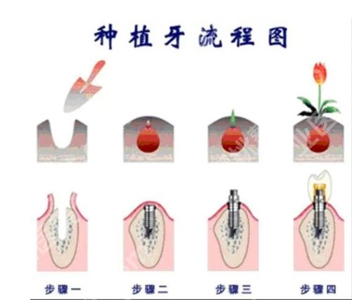 北京佳美口腔医院牙齿矫正价格是多少？看医院详细介绍