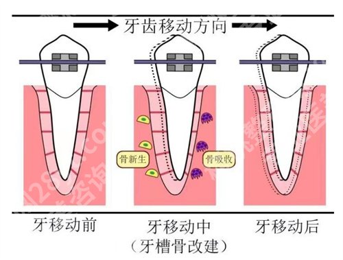 北京佳美口腔医院牙齿矫正价格是多少？看医院详细介绍