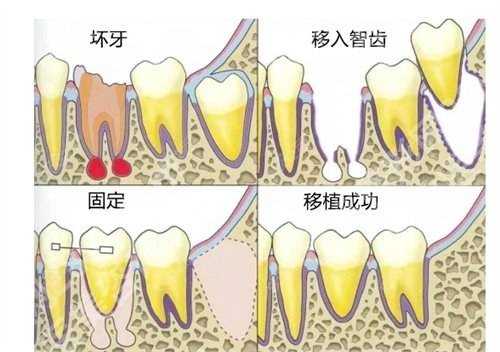 北京冠美口腔医院种牙好不好？医院核心项目介绍