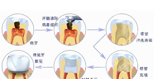 北大口腔医院做地包天手术多少钱？医院详情介绍，医生实力在线