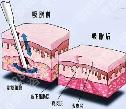 中日医院整形美容价格是多少？科普热门项目价格信息