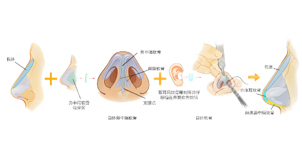 上海九院整形价格是多少？价格参考为9000元起