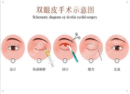 北京朝阳医院整形外科价格是多少？优选费用标准一览