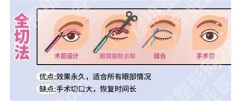 西安画美张莎莎做双眼皮怎么样？看医院专业团队介绍