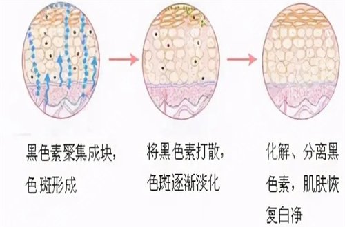 北京润美玉之光吸脂瘦腿价格贵呀！明星项目展开介绍