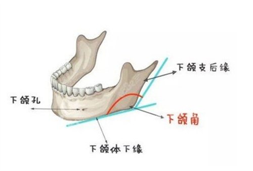 北京圣嘉新下颌角修复怎么样？附价格更新+医生推荐