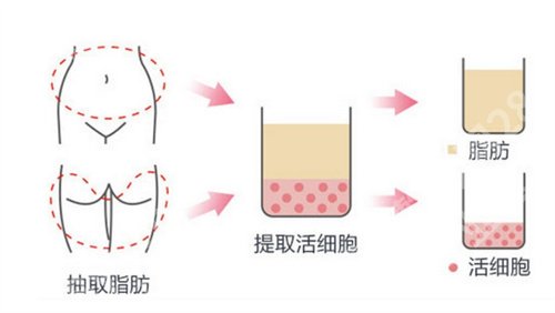 上海俏佳人医疗美容评价怎么样？经典项目告知了