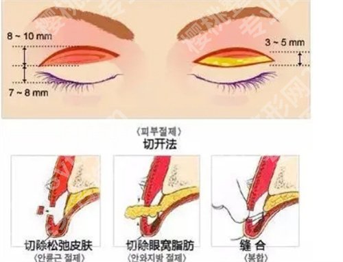 北京炫美眼部整形怎么样？项目推荐+真实案例