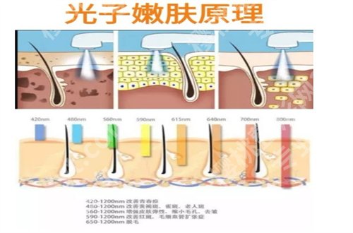 北京京城皮肤医院预约快吗？跟随内容一起看项目优势