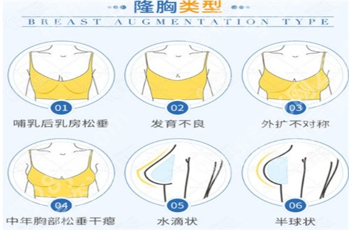 唐新辉医生做隆胸好吗？真实案例展示，看新价格表