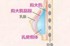 上海吕京陵医生做胸怎么样？医生特色项目介绍