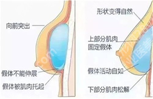 栾杰医生缩胸的手术收费怎么样？医生实力介绍