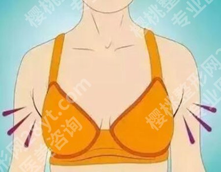 哈医大一院郝立君做副乳手术怎么样？从事副乳手术多年